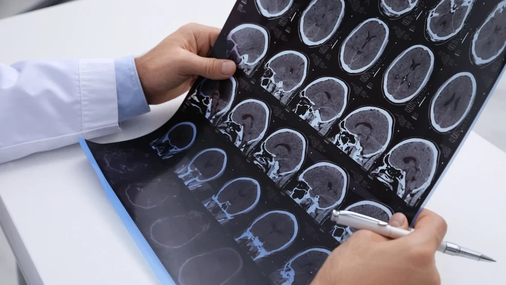 ∆εν είναι ανίατη η πολλαπλή σκλήρυνση